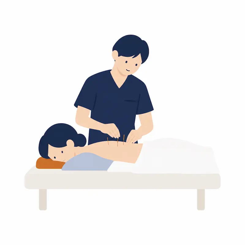 うつ伏せの方の背中に鍼をしている様子のイラスト